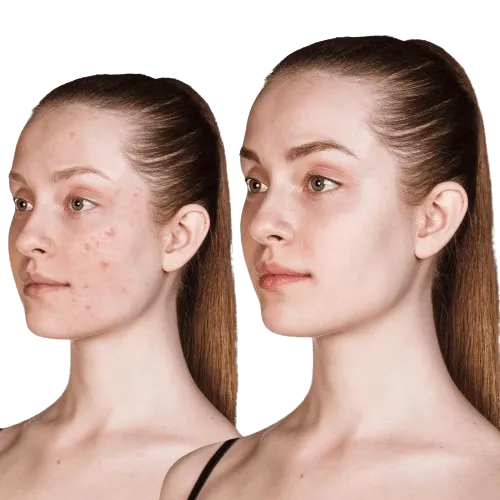 Led Facial Beauty instrument